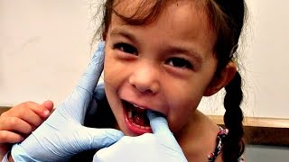 TODDLER TONGUE TIE DIAGNOSIS [upl. by Alial692]