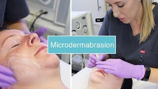 Microdermabrasion  The Laser and Skin Clinic [upl. by Swithbart]