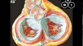 Animated Mitral Regurgitation Murmur [upl. by Tap]