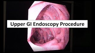 Upper Endoscopy for GERD Best Practice Advice from ACP [upl. by Esya211]