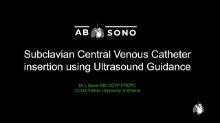 Part 2 Axotrack Tips  Subclavian Vein Central Venous Access [upl. by Forlini]