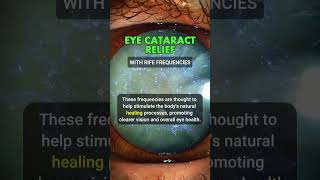 RIFE Frequencies for Eye CATARACT Relief [upl. by Hallagan]