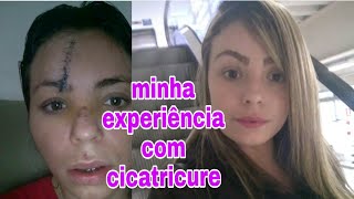 CICATRICURE FUNCIONA Minha experiência [upl. by Atneciv865]