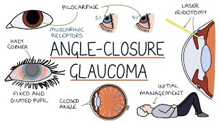 How To Improve Glaucoma – DrBerg On Glaucoma Treatment [upl. by Asirac]