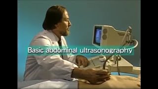 How to do abdominal ultrasound examination [upl. by Aneloj]