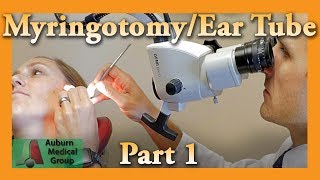 Myringotomy amp Ear Tube Part 1 Feat Dr Tim Fife  Myringotomy  Auburn Medical Group [upl. by Sudderth]