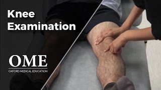 Knee Examination  Orthopaedics [upl. by Ahslek305]