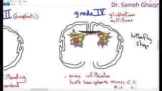 Basal Cell Carcinoma BCC 101  Dermpath Basics Explained by a Dermatopathologist [upl. by Mccomb231]