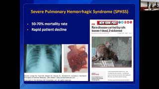 Leptospirosis Clinical Disease and Diagnosis in Humans [upl. by Gnal]