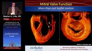 Mitral Stenosis Stephen H Little MD Sunday August 21 2016 [upl. by Meadows14]