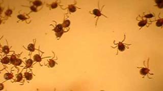 newborn tick larvae 2 [upl. by Trebor]