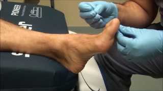 Neurologic Examination of the Foot Pin Prick Testing [upl. by Einot85]