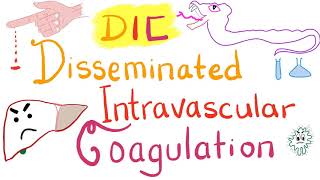 Thrombocytopenia Hemostasis  Lesson 8 [upl. by Garbers]