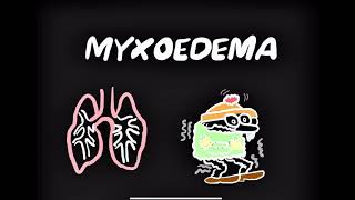 Myxoedema Coma CauseSymptoms Treatment [upl. by Kirbie]