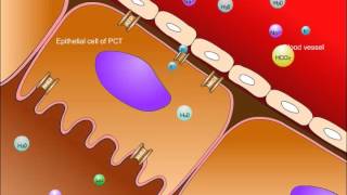 Multiple Myeloma  signs and symptoms pathophysiology treatment [upl. by Ddene]