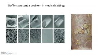 Biofilms and quorum sensing [upl. by Hube733]