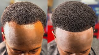 HOW TO FIX A BALDING RECEDING HAIRLINE  PERFECT HAIRCUT FIX [upl. by Anayia]