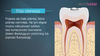 Jak powstaje próchnica [upl. by Crandell54]