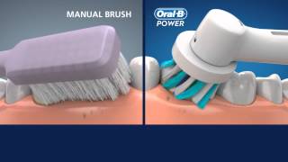 OralB CrossAction vs manual toothbrush [upl. by Emoreg]