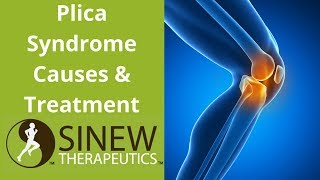 Plica Syndrome Causes and Treatment [upl. by Enelec300]